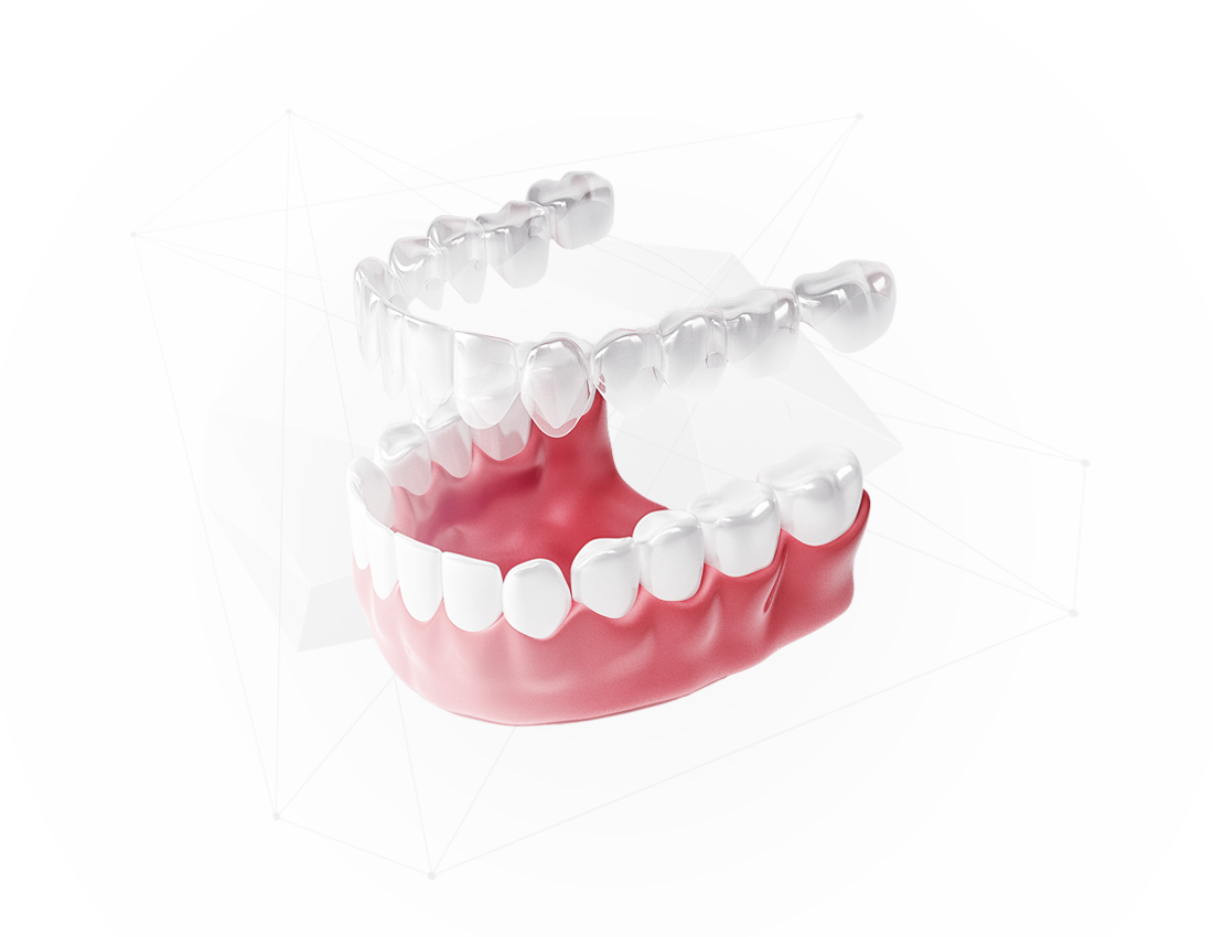 Элайнеры Star Smile